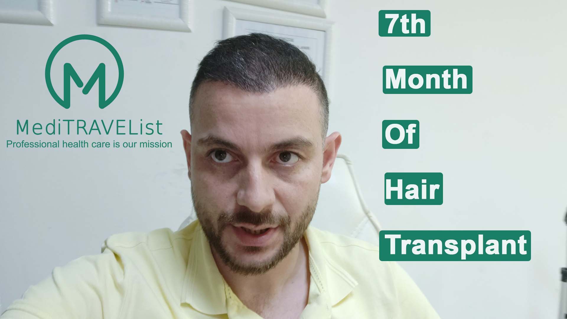 7 th month of Hair transplantation video cover image