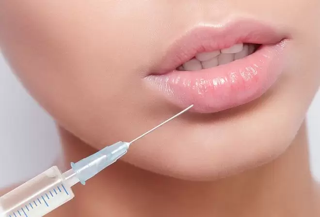 Hyaluronic Acid Injection for Lips or Face