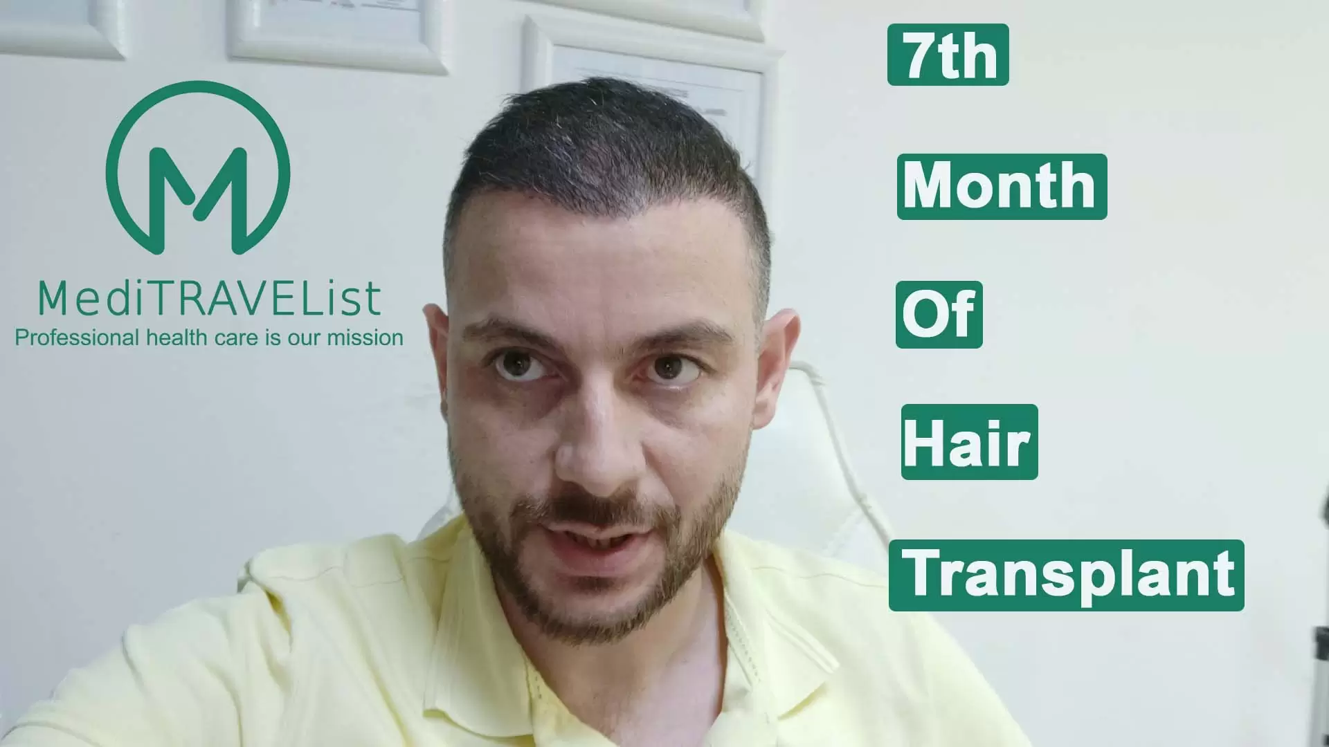 7 th month of Hair transplantation video cover image